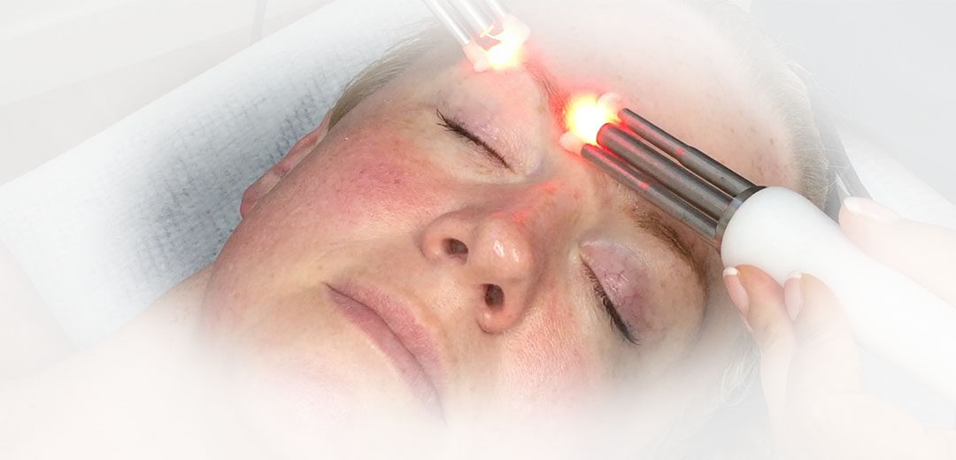 CACI Eye Lift Facial 20mins- £25